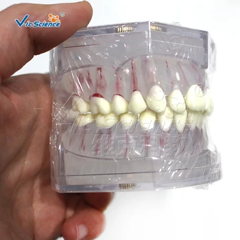Стандартен модел на бели зъби с пълна уста